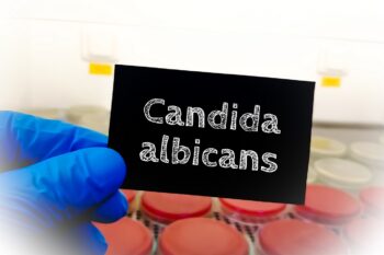 Candidoza – simptomele infecției cu Candida Albicans. Management și tratament